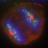 蛍光免疫染色：HeLa細胞　分裂後期（染色体分配）　高橋撮影