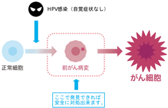 hpv_image